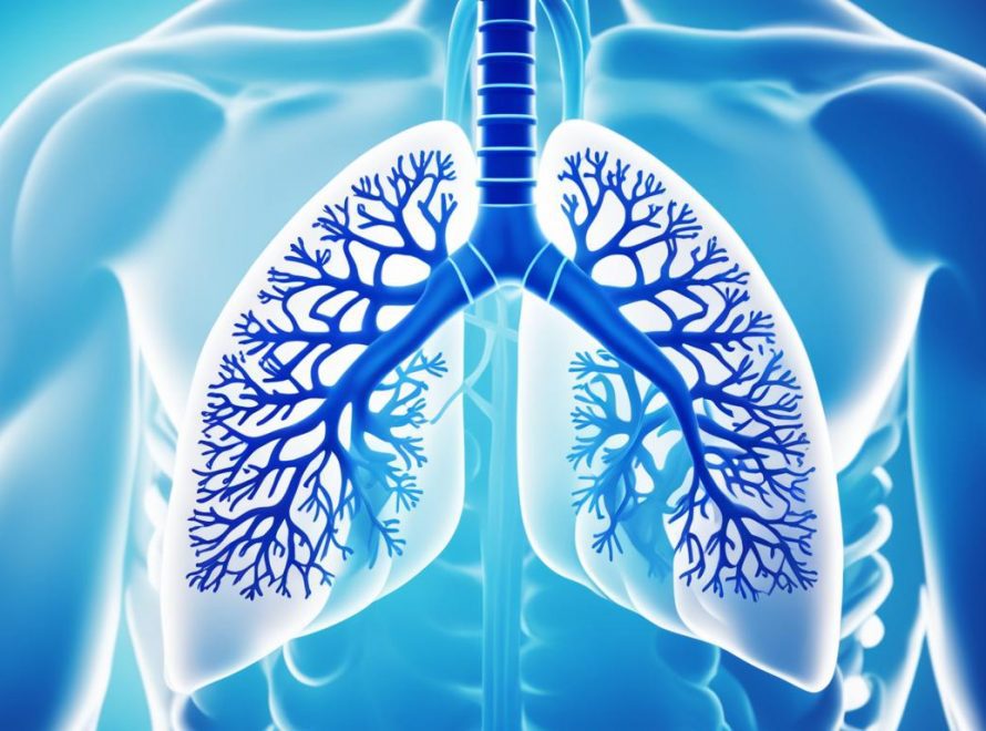 Pulmonary edema